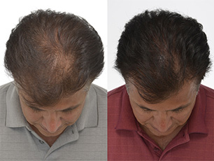 iGrow Before and After