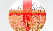 Low-Level Laser Therapy