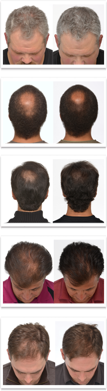 Men Before and After